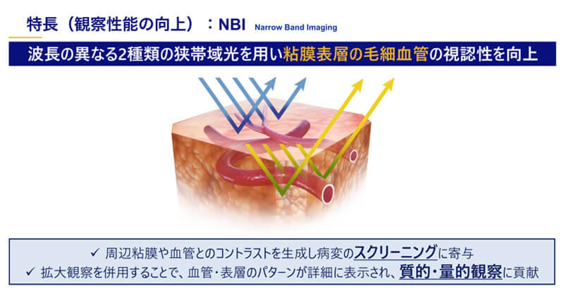 NBI写真